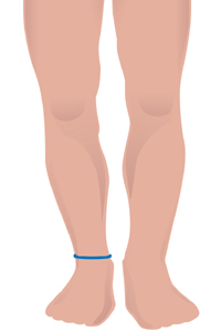 m-ankle.jpg m-ankle.jpg