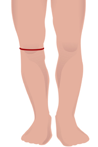 m-knee.jpg m-knee.jpg
